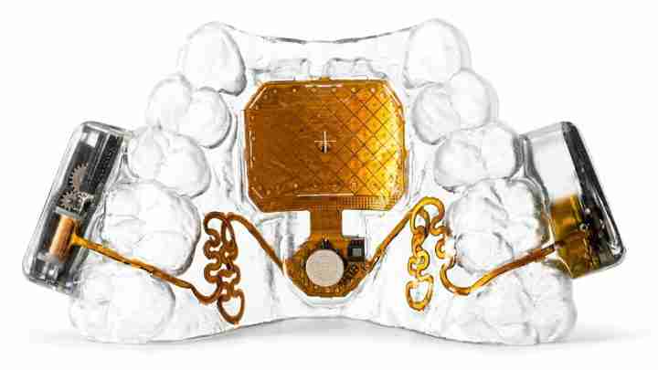 Dental jaw model showing an embedded gold-colored implant device with circuitry and connectors styling the upper palate area (informative image).